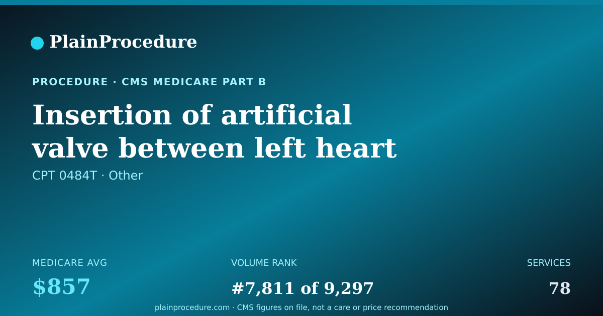 Shareable card for Insertion Of Artificial Valve Between Left Heart Chambers, Open Chest Procedure