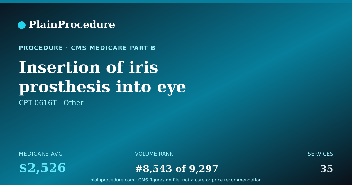 Shareable card for Insertion Of Iris Prosthesis Into Eye