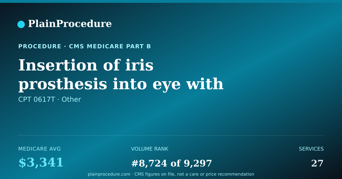 Shareable card for Insertion Of Iris Prosthesis Into Eye With Removal Of Lens And Insertion Of Artificial Lens
