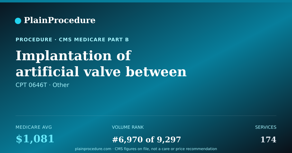 Shareable card for Implantation Of Artificial Valve Between Right Upper And Lower Chambers Of Heart Through Catheter