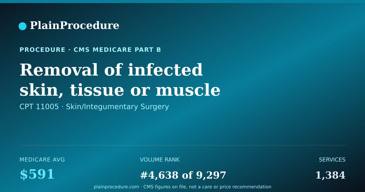 Shareable card for Removal Of Infected Skin, Tissue Or Muscle Of Abdomen