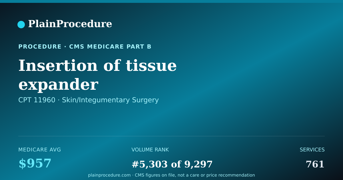 Shareable card for Insertion Of Tissue Expander