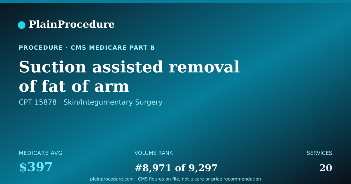 Shareable card for Suction Assisted Removal Of Fat Of Arm
