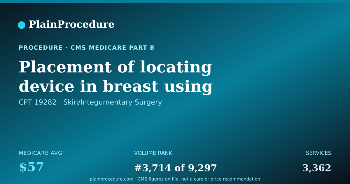 Shareable card for Placement Of Locating Device In Breast Using Imaging Guidance, Each Additional Growth