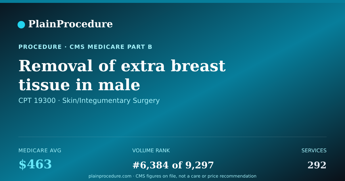 Shareable card for Removal Of Extra Breast Tissue In Male
