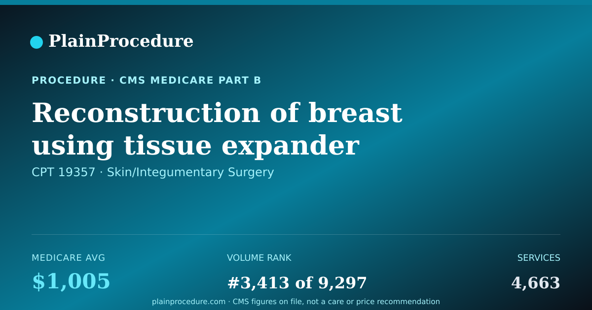 Shareable card for Reconstruction Of Breast Using Tissue Expander