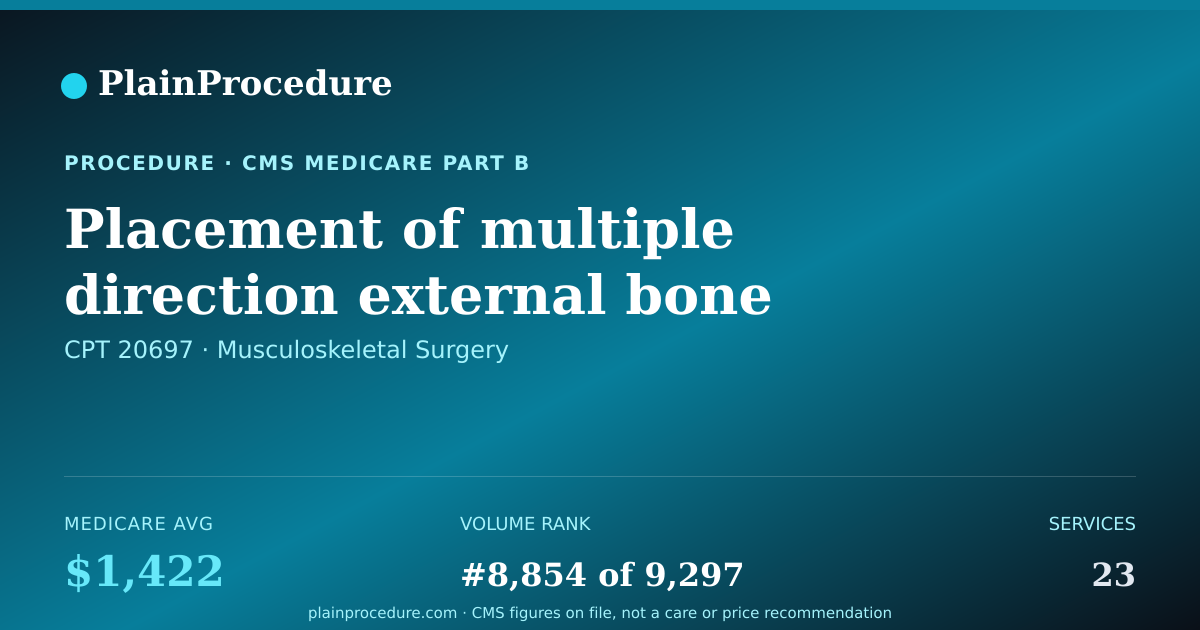 Shareable card for Placement Of Multiple Direction External Bone Stabilizing Device To Arm Or Leg Using Imaging Guidance