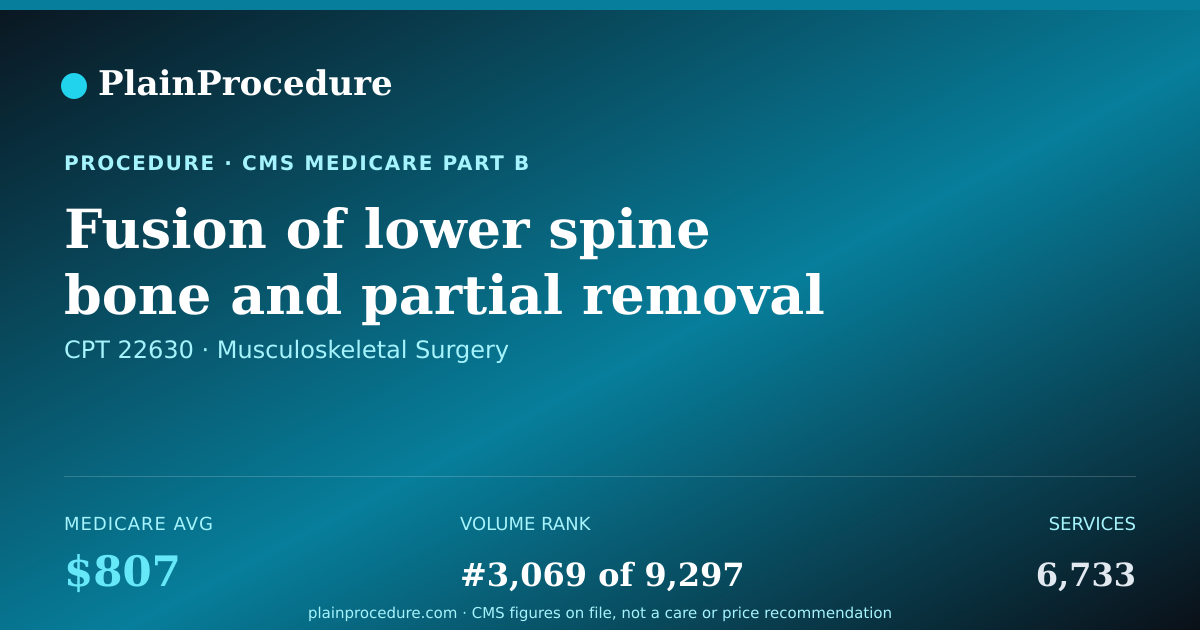 Shareable card for Fusion Of Lower Spine Bone And Partial Removal Of Spine Bone Or Disc Through Back, 1 Disc