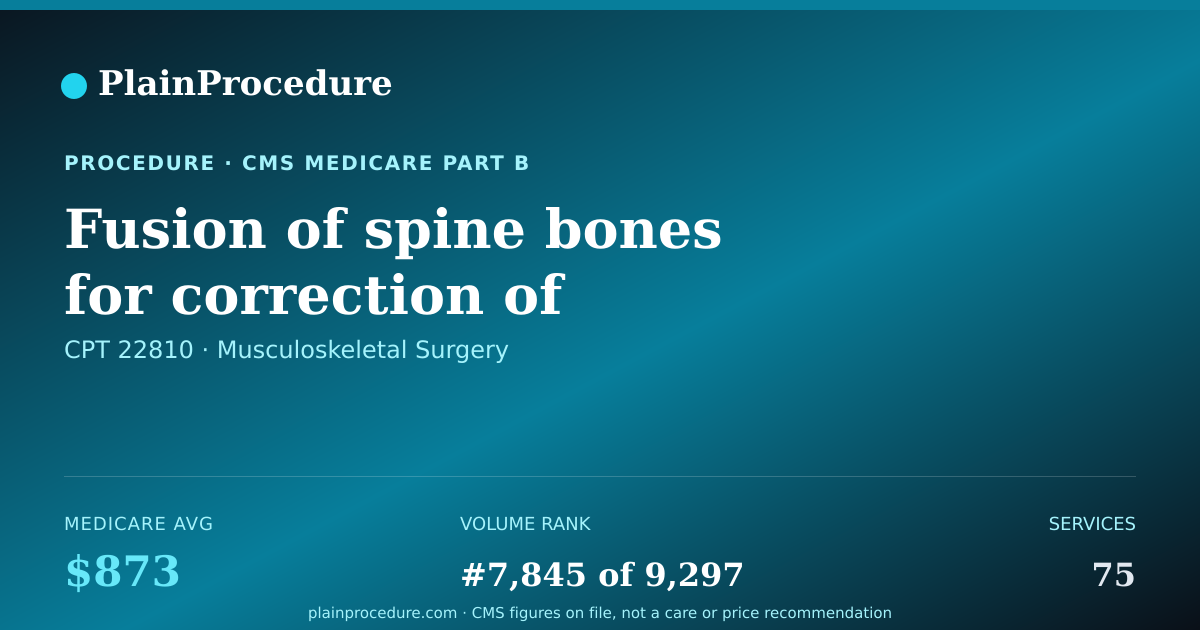 Shareable card for Fusion Of Spine Bones For Correction Of Deformity, Anterior Approach, 4 To 7 Vertebral Segments