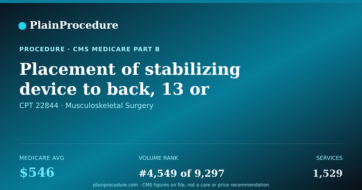 Shareable card for Placement Of Stabilizing Device To Back, 13 Or More Spine Bone Segments