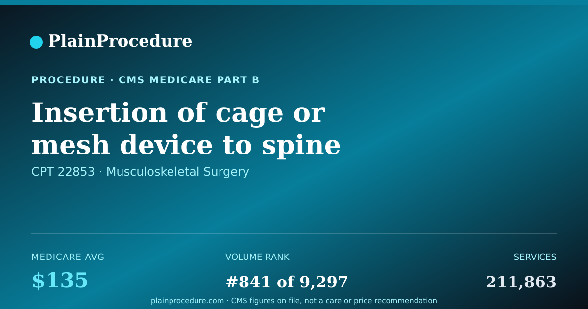 Shareable card for Insertion Of Cage Or Mesh Device To Spine Bone And Disc Space During Spine Fusion