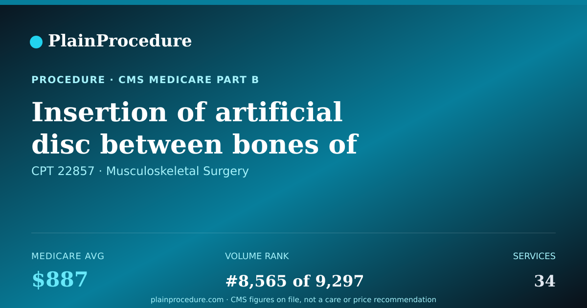 Shareable card for Insertion Of Artificial Disc Between Bones Of Lower Spine, Single Space
