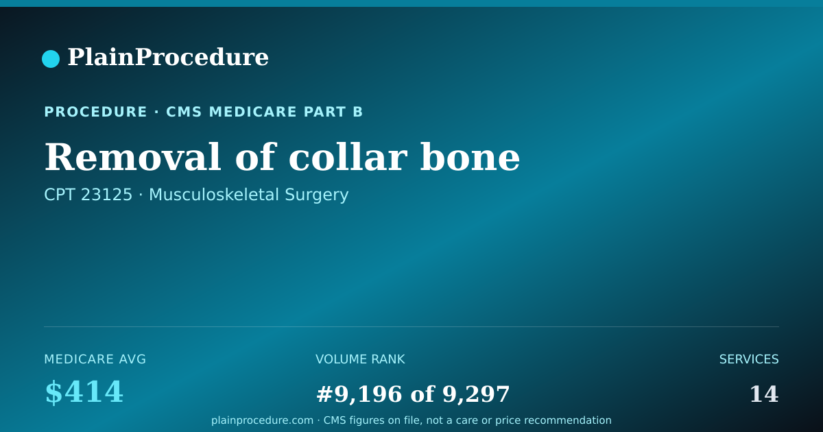 Shareable card for Removal Of Collar Bone