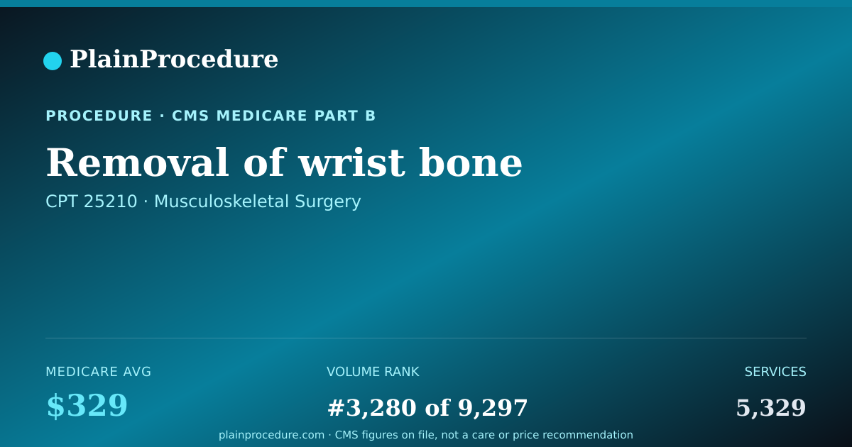 Shareable card for Removal Of Wrist Bone