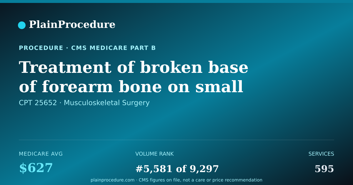 Shareable card for Treatment Of Broken Base Of Forearm Bone On Small Finger Side At Wrist
