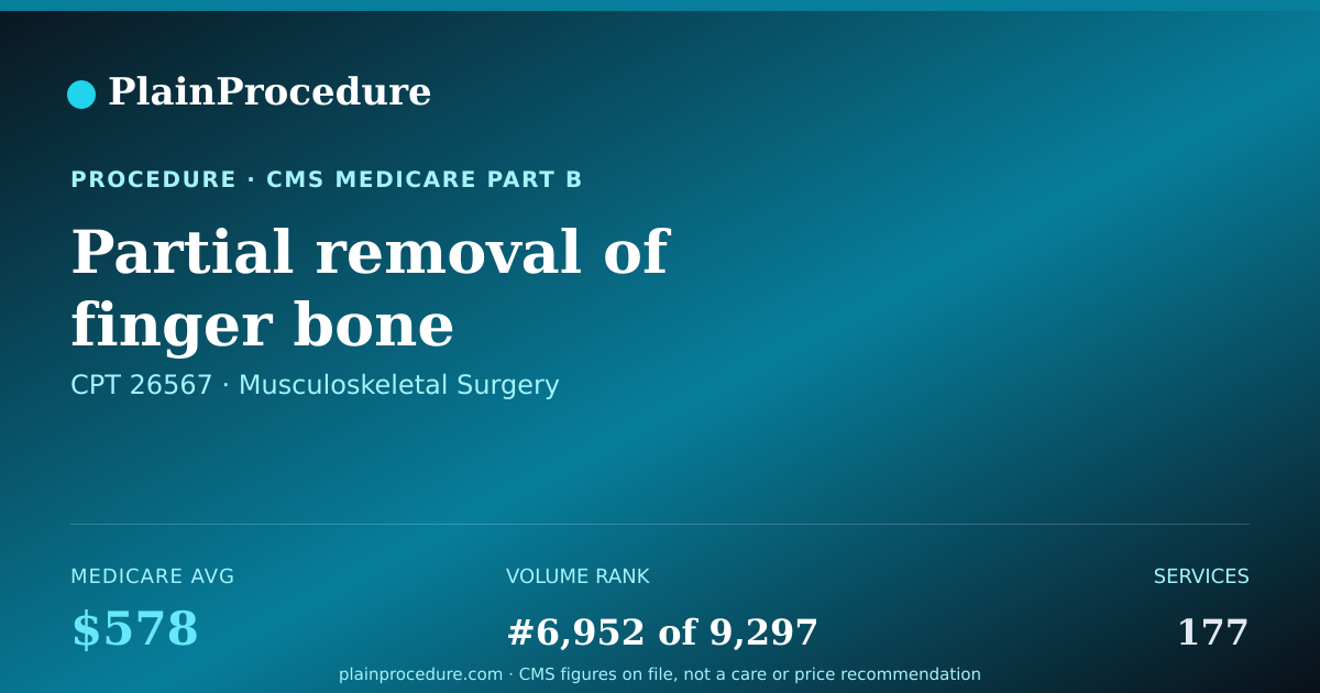 Shareable card for Partial Removal Of Finger Bone