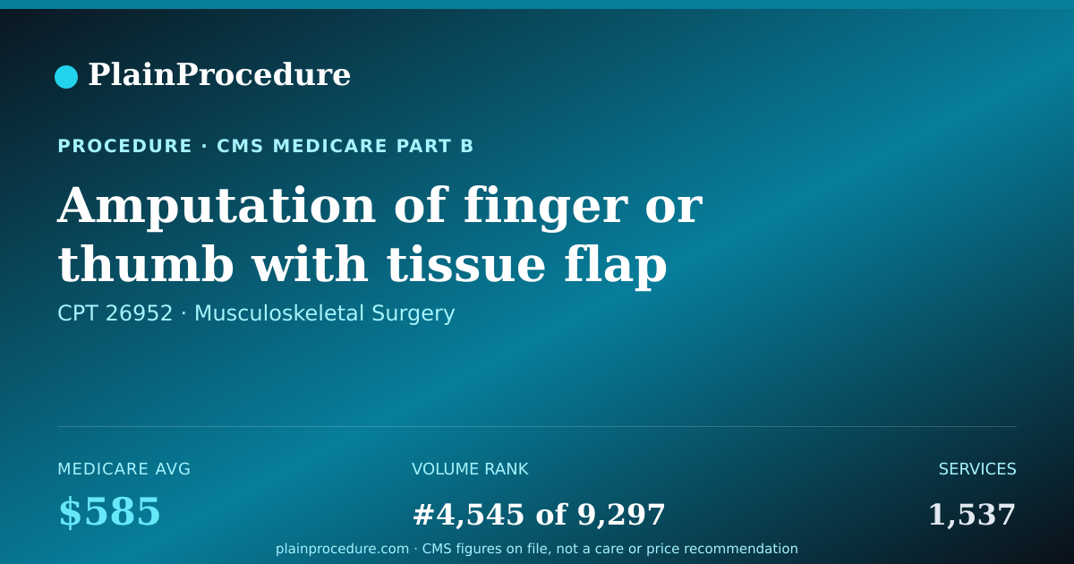 Shareable card for Amputation Of Finger Or Thumb With Tissue Flap