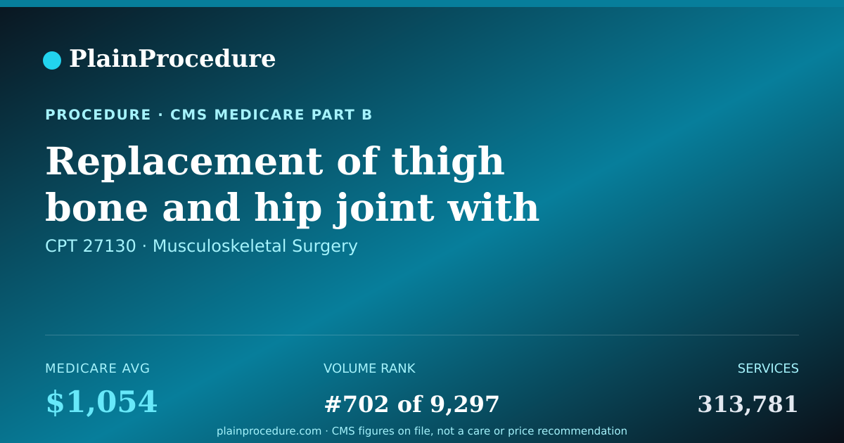 Shareable card for Replacement Of Thigh Bone And Hip Joint With Prosthesis