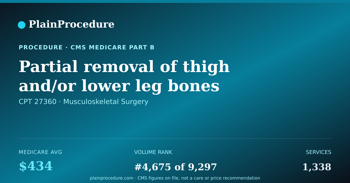 Shareable card for Partial Removal Of Thigh And/or Lower Leg Bones