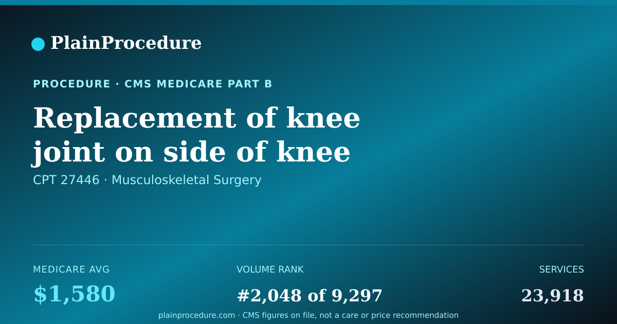 Shareable card for Replacement Of Knee Joint On Side Of Knee