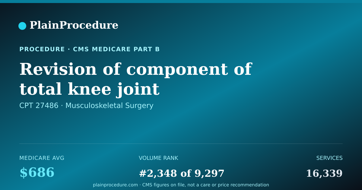 Shareable card for Revision Of Component Of Total Knee Joint Prosthesis