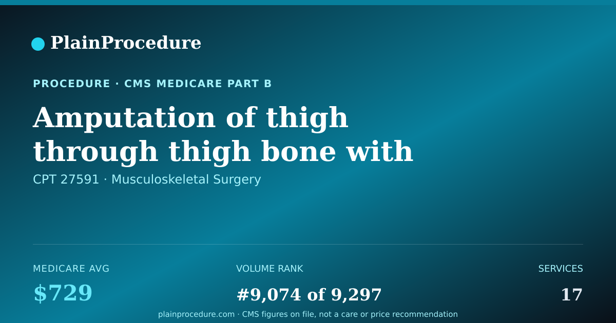 Shareable card for Amputation Of Thigh Through Thigh Bone With Immediate Fitting For Prosthesis