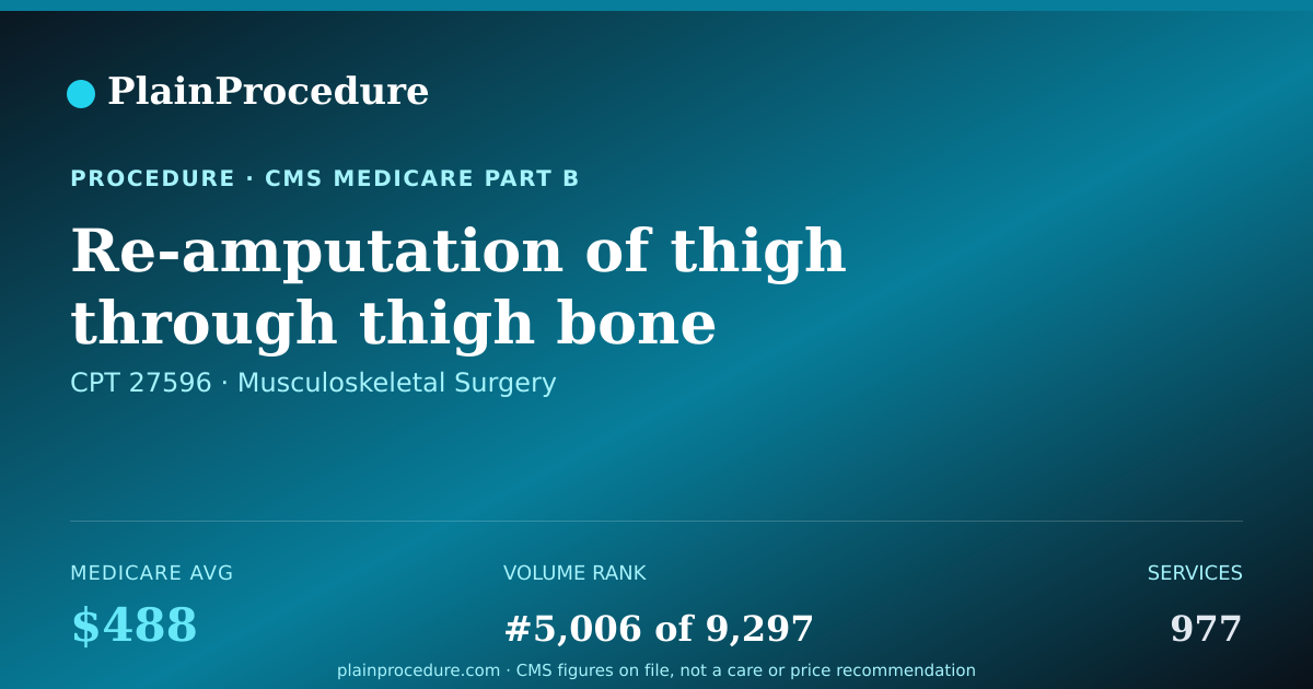 Shareable card for Re-Amputation Of Thigh Through Thigh Bone