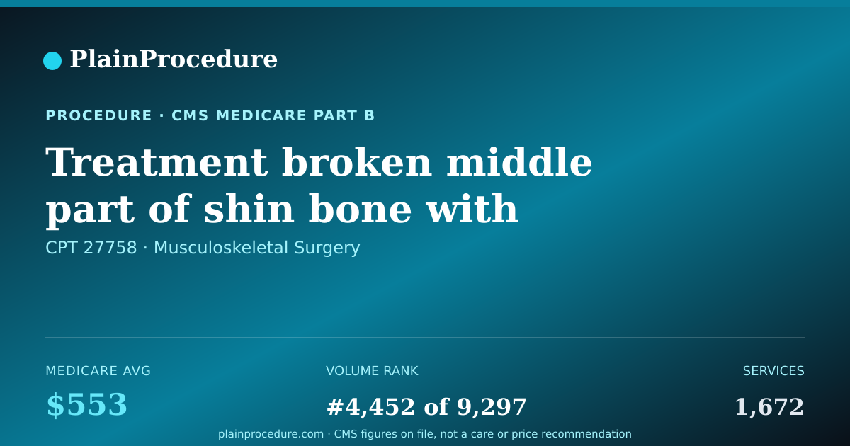 Shareable card for Treatment Broken Middle Part Of Shin Bone With Plate Or Screws