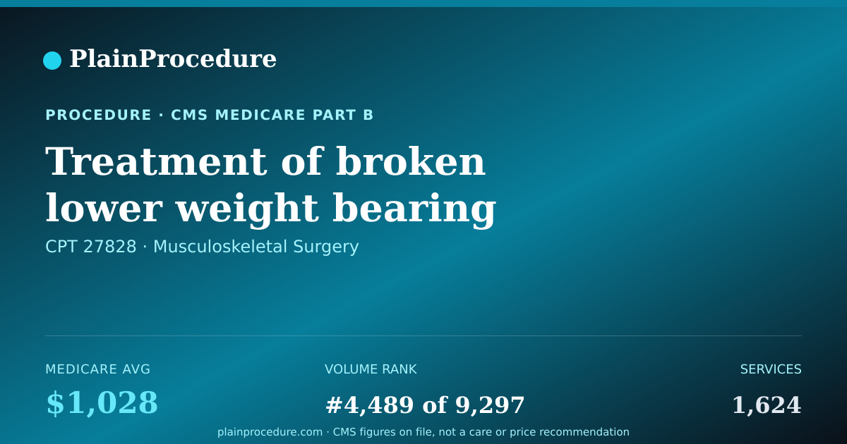 Shareable card for Treatment Of Broken Lower Weight Bearing Joint Of Both Lower Leg Bones