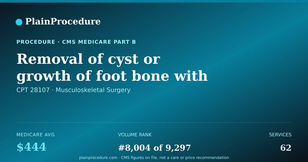 Shareable card for Removal Of Cyst Or Growth Of Foot Bone With Bone Graft