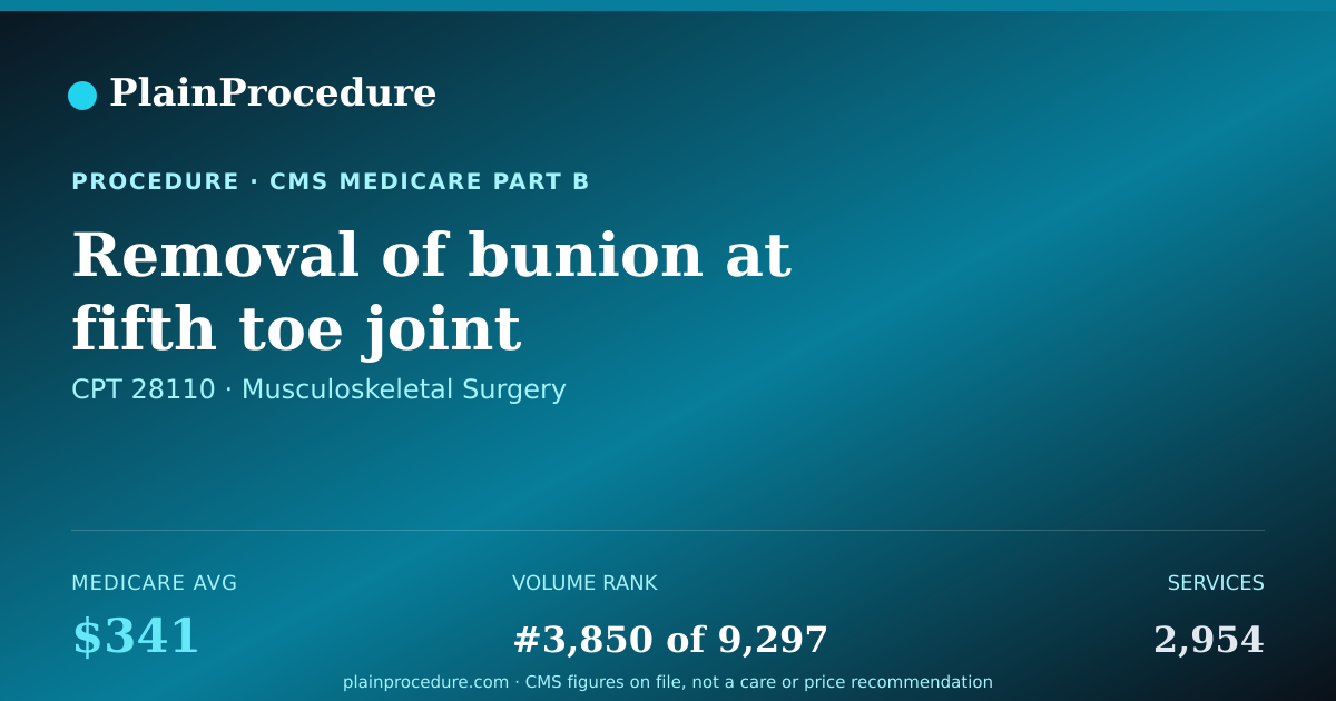 Shareable card for Removal Of Bunion At Fifth Toe Joint
