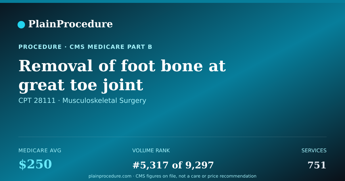Shareable card for Removal Of Foot Bone At Great Toe Joint