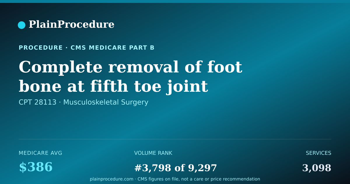 Shareable card for Complete Removal Of Foot Bone At Fifth Toe Joint
