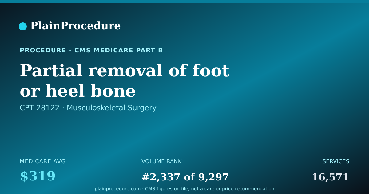 Shareable card for Partial Removal Of Foot Or Heel Bone