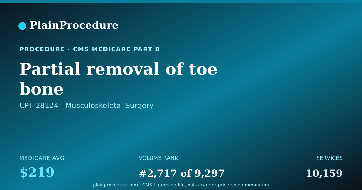 Shareable card for Partial Removal Of Toe Bone