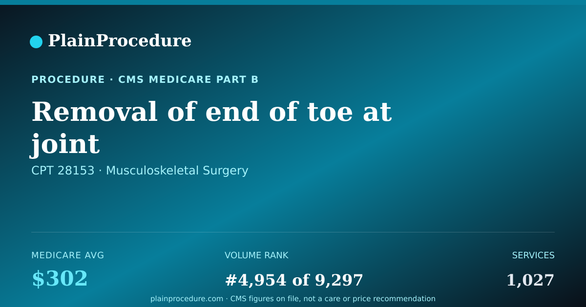 Shareable card for Removal Of End Of Toe At Joint