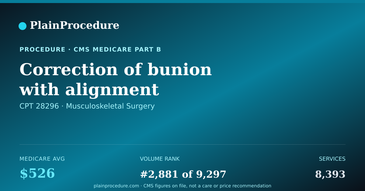 Shareable card for Correction Of Bunion With Alignment Correction Of Midfoot Bone Toward Toe Area