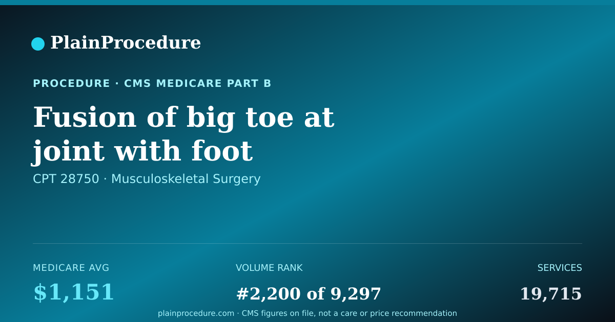 Shareable card for Fusion Of Big Toe At Joint With Foot