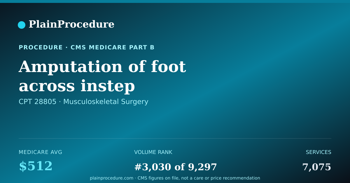 Shareable card for Amputation Of Foot Across Instep