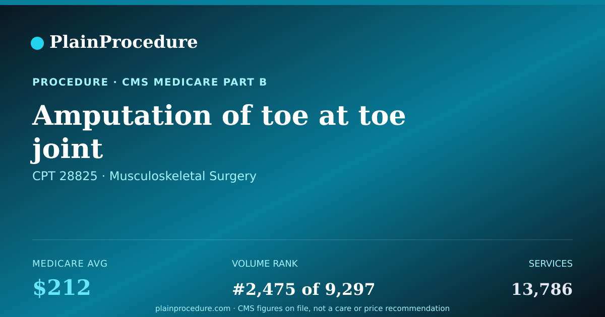 Shareable card for Amputation Of Toe At Toe Joint