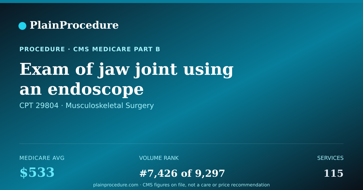 Shareable card for Exam Of Jaw Joint Using An Endoscope