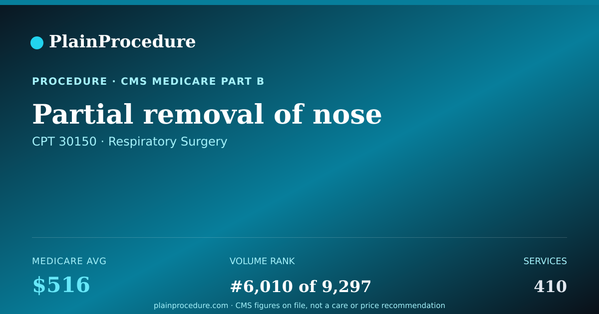 Shareable card for Partial Removal Of Nose