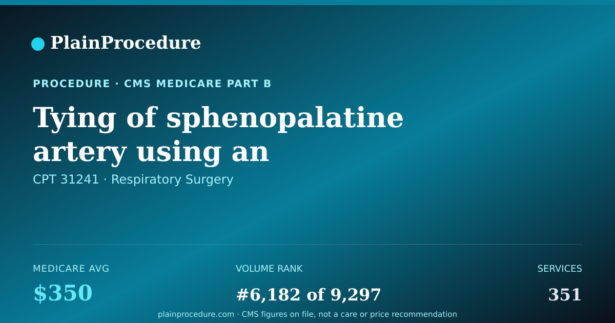 Shareable card for Tying Of Sphenopalatine Artery Using An Endoscope
