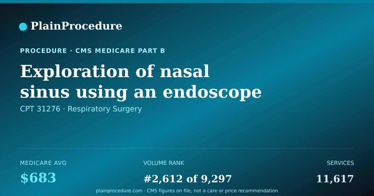 Shareable card for Exploration Of Nasal Sinus Using An Endoscope