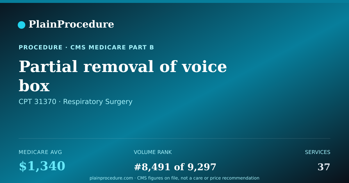 Shareable card for Partial Removal Of Voice Box
