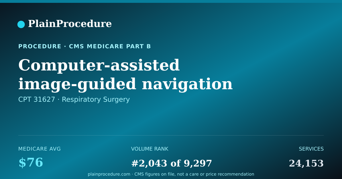 Shareable card for Computer-Assisted Image-Guided Navigation Of Lung Airways Using An Endoscope
