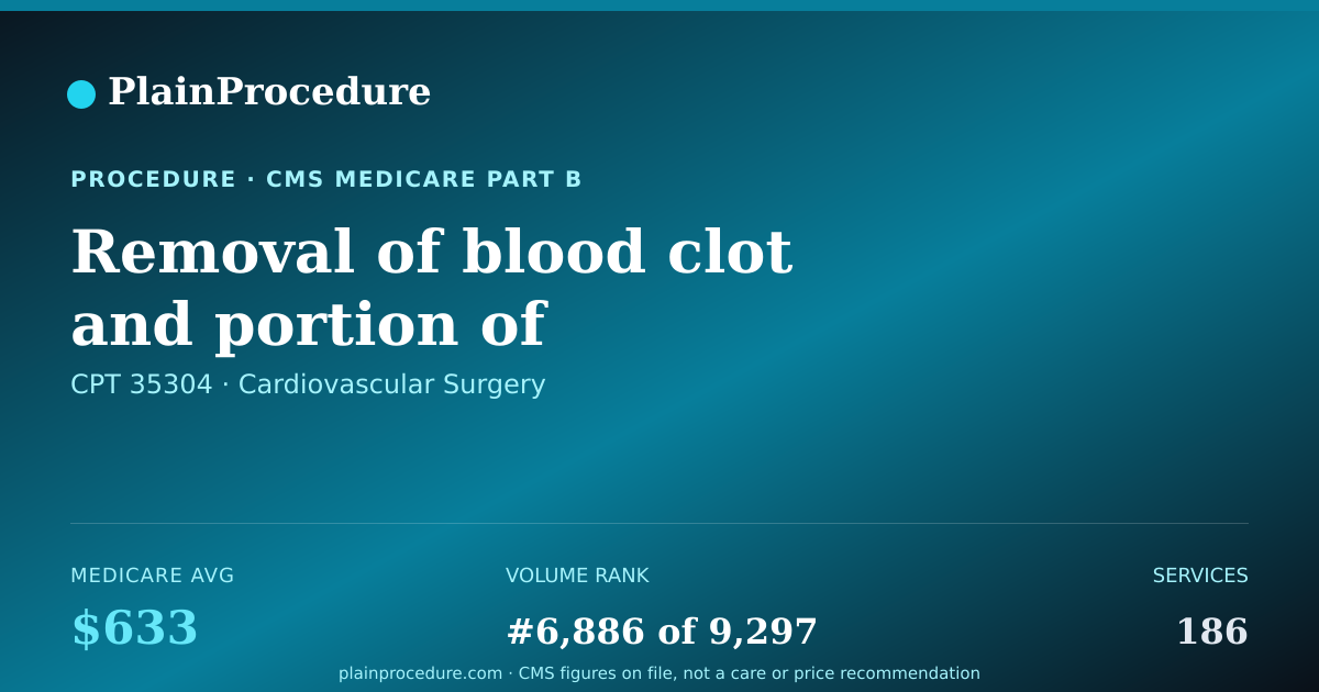 Shareable card for Removal Of Blood Clot And Portion Of Tibioperoneal Trunk Artery
