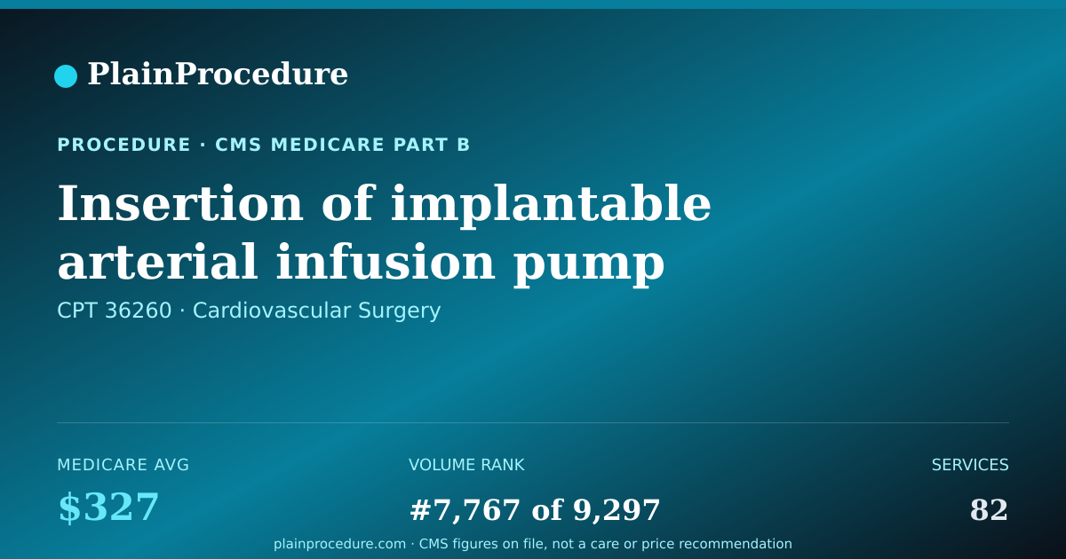 Shareable card for Insertion Of Implantable Arterial Infusion Pump