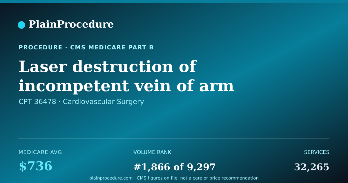 Shareable card for Laser Destruction Of Incompetent Vein Of Arm Or Leg Using Imaging Guidance