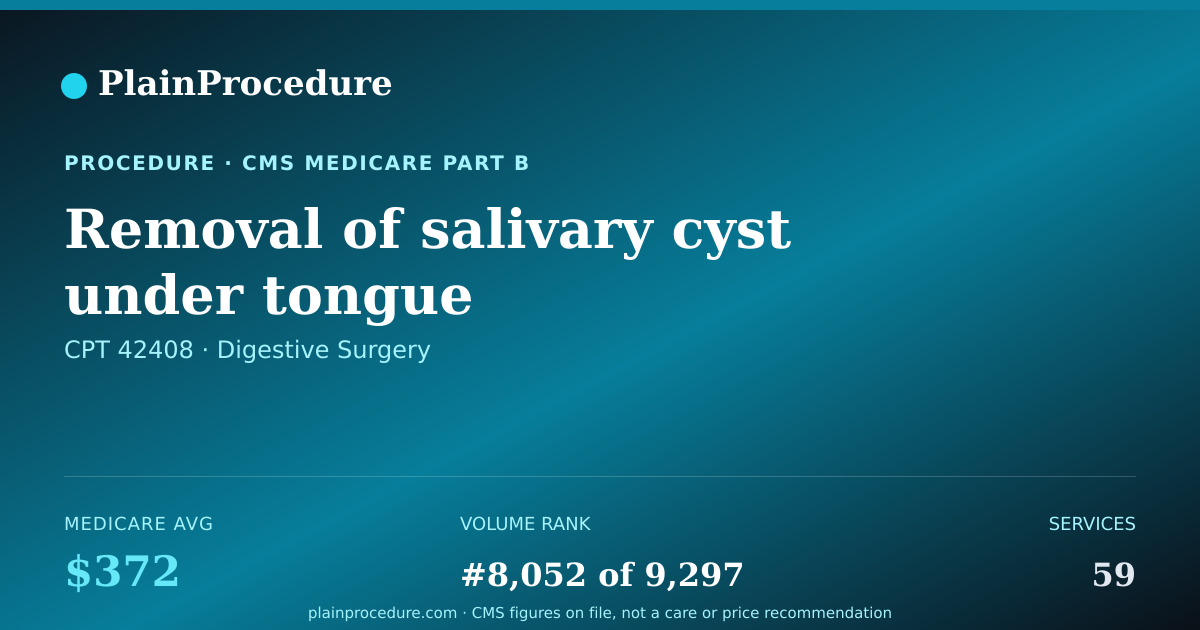 Shareable card for Removal Of Salivary Cyst Under Tongue